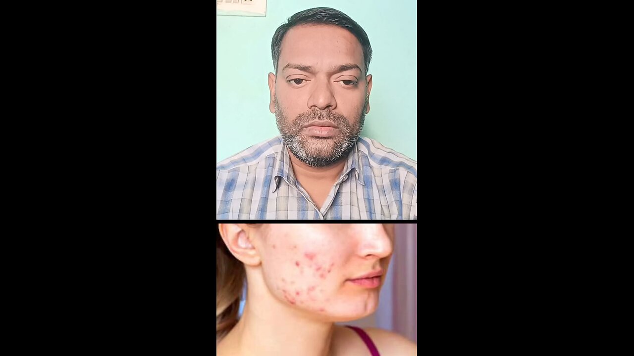 त्वचा की बीमारियों का आयुर्वेदिक इलाज ।