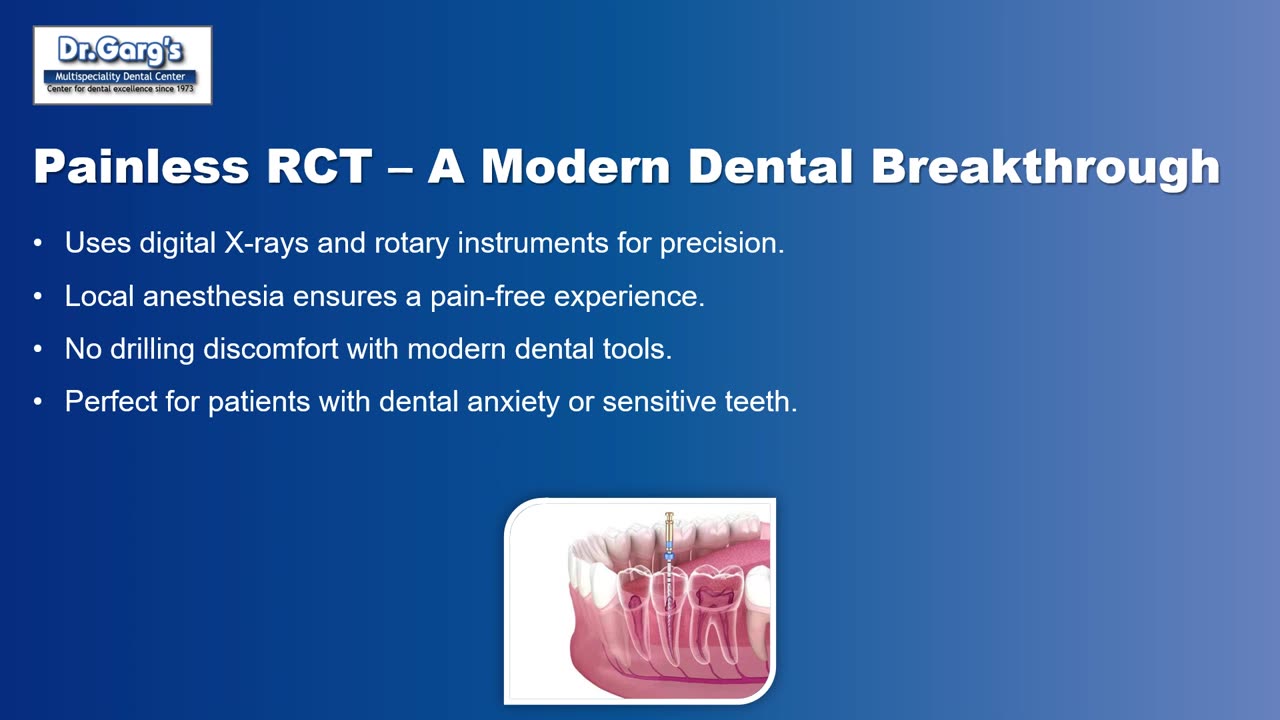 Experience Painless & Efficient Root Canal Treatment at Dr. Garg’s Multispeciality Dental Center