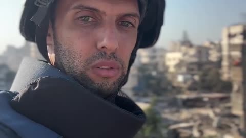 Before After😢💔