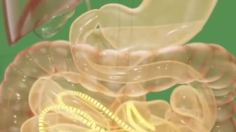 5 signs you have a parasite and how to fix it