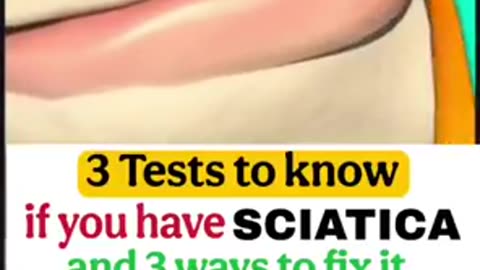 3 tests to know if you have sciatica or not and 3 ways to fix it.