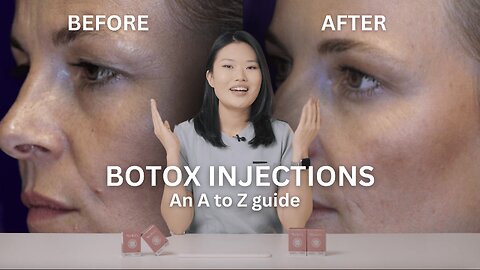 How to use Botox/ Botulinum Toxin: where, how much, how often?