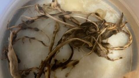 Funeral Director Exposes ClotShot Clots. "Covid vaccinated people are now dying off."