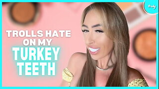 Haters Say My Turkey Teeth Are "A Joke" | HOOKED ON THE LOOK