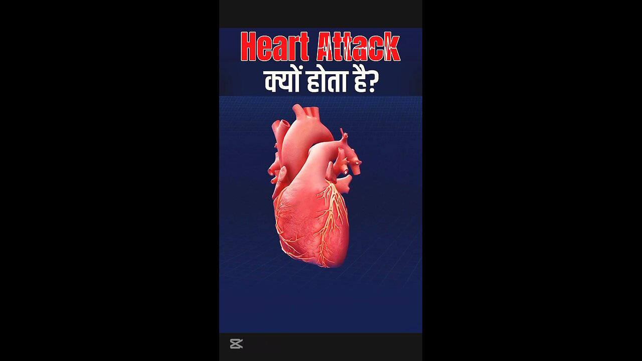 Why HEART ATTACKS Happen हार्ट अटैक कैसे होता है #whyheartattackhappen #हार्टअटैककैसेहोताहै