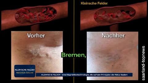 🔎 👀 Klein‘sche Felder – wie wirken sie wirklich?