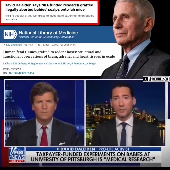 Fauci was grafting illegally aborted babies scalps onto lab mice. 😳