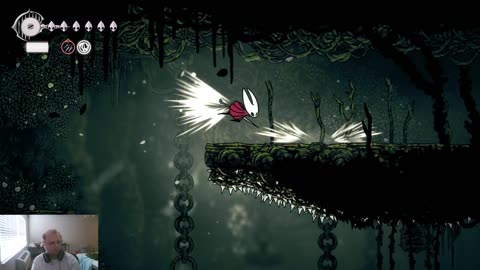 Hollow Knight Silksong Part 2 Backwards Shirt Widow