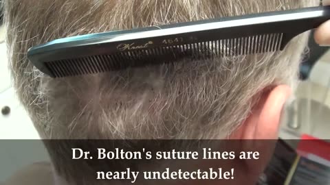 Dr. Brett Bolton | Undetectable Suture Line in Just 10 Days