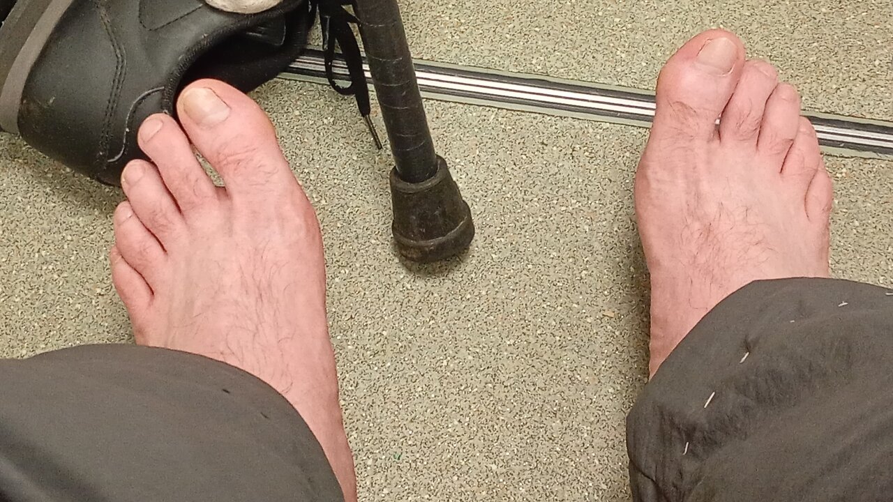 #NHS , have to go bare foot or insult doctor,