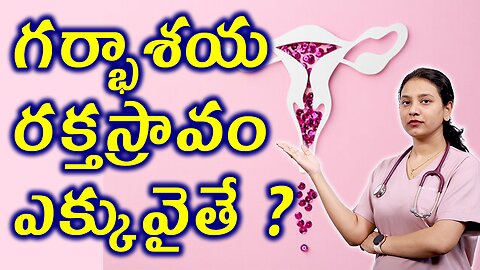 గర్భాశయ రక్తస్రావం ఎక్కువైతే Abnormal Uterine Bleeding Trusted Homeopathy Treatment Cure Causes
