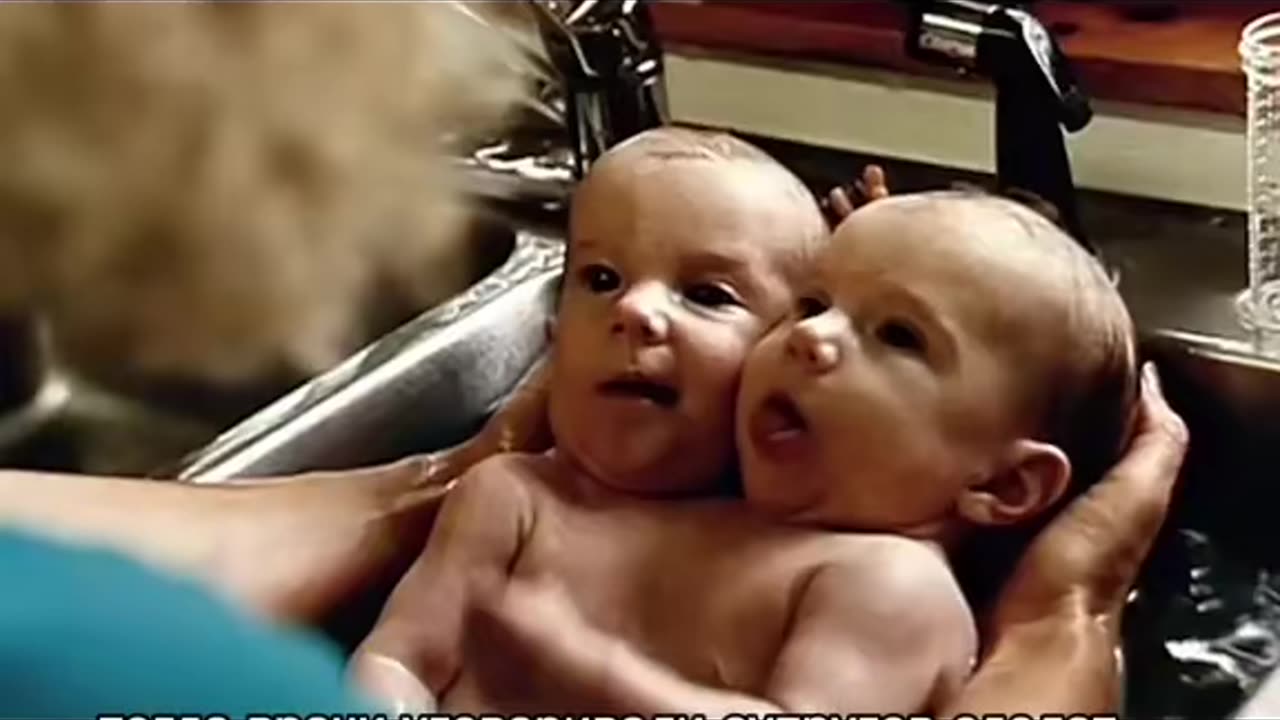 🤯👽 Удивительная история двух сестер Эбби и Британи в одном видео! | TheTruthAbove