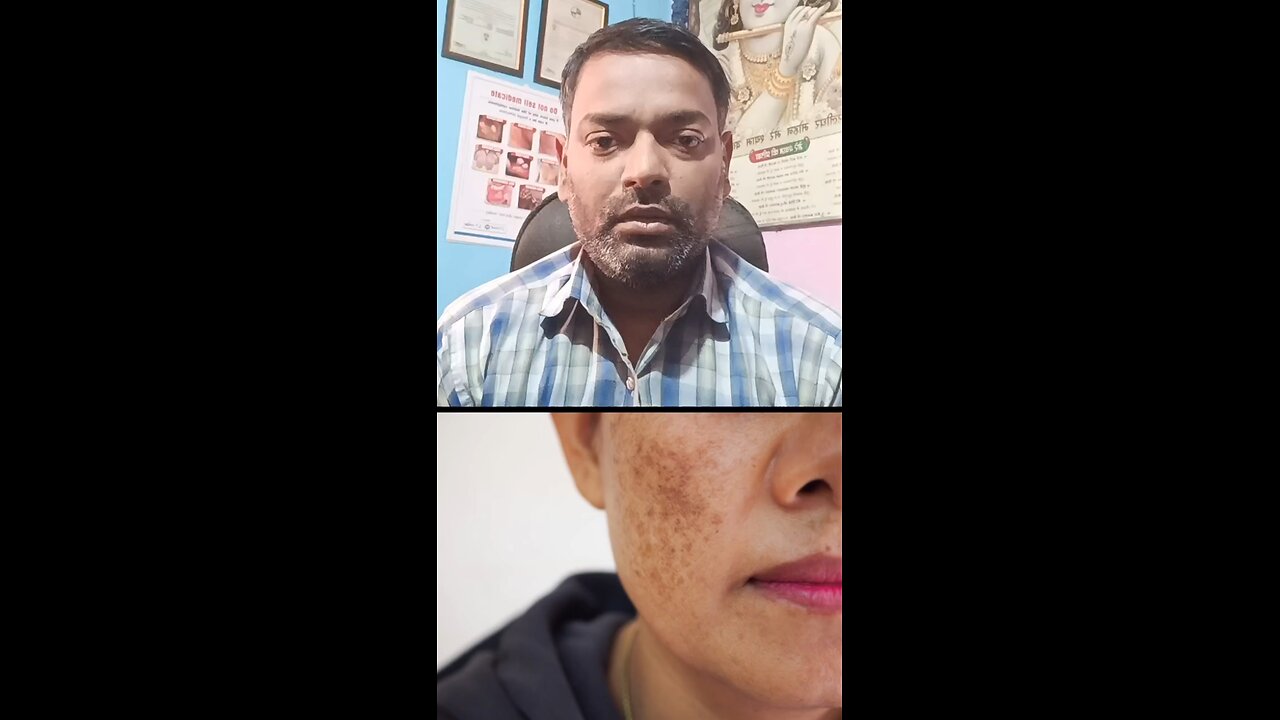 झाइयों का इलाज ।