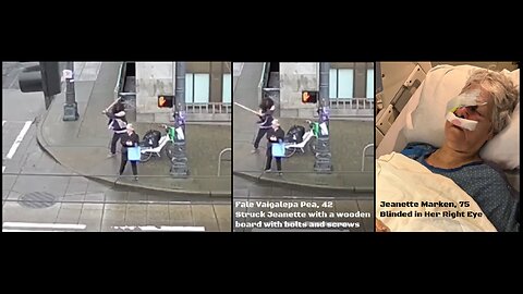 Grandma BLINDED by WOOD PLANK with SCREW Used by an Attacker Released 8 TIMES by DEMS