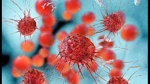 Dr Thomas Seyfried cancer expert Revealing cancers prevention