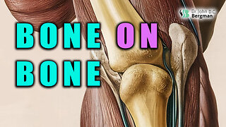 ⁉️BONE On BONE 🦴🩻⁉️