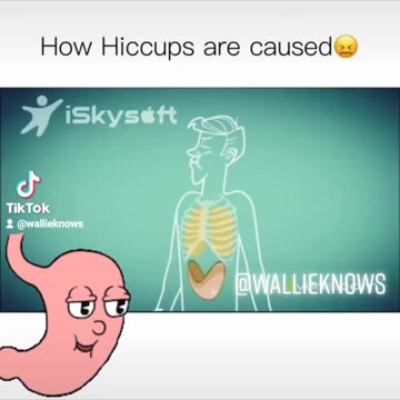 How hiccups are caused
