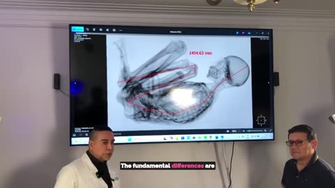 👨‍⚕️👽 Dr. David Ruiz Vela's Expert Opinion on Tridactyls! | TheTruthAbove