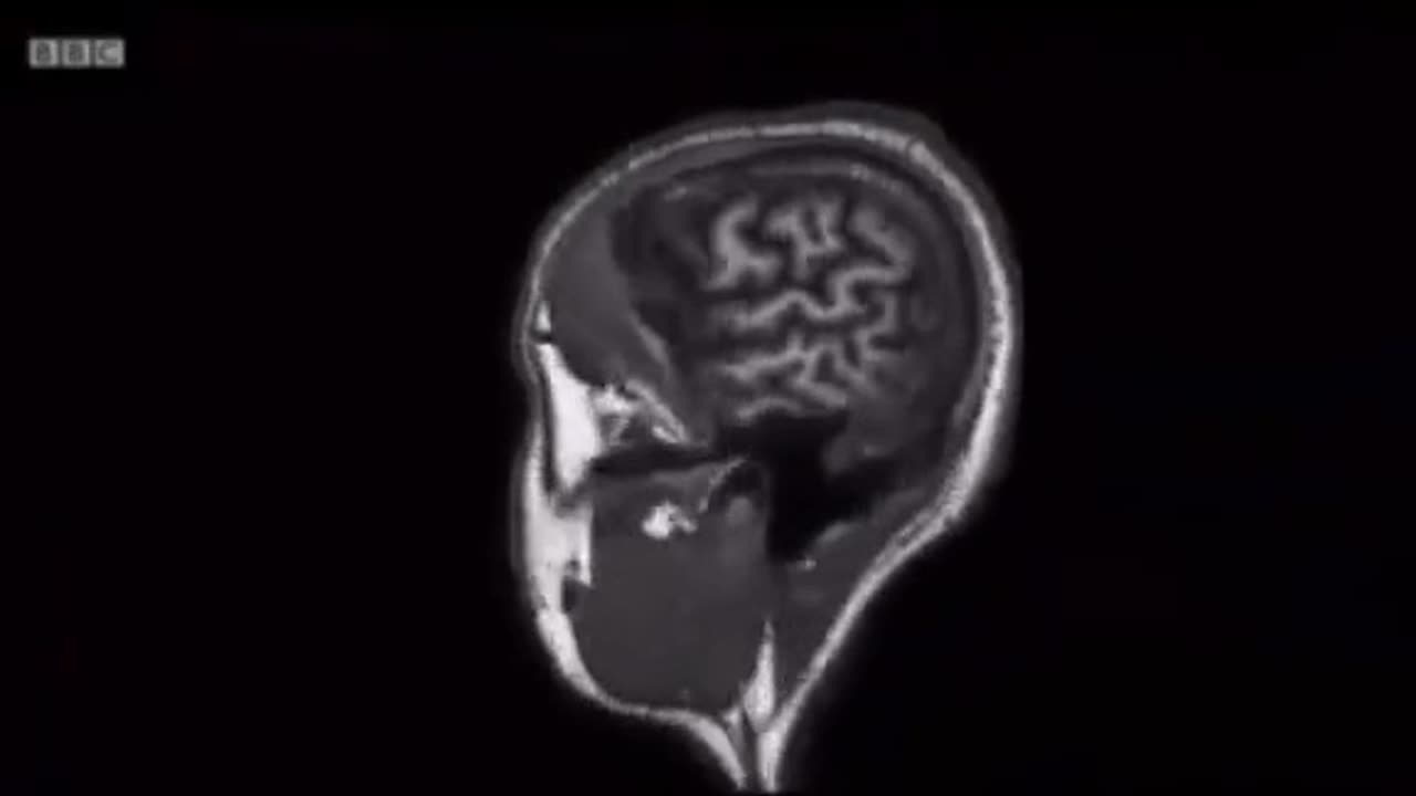 Your brain on an ultra-processed food diet