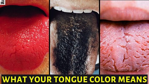 How Your Tongue’s Color, Texture & Appearance Affect Your Health