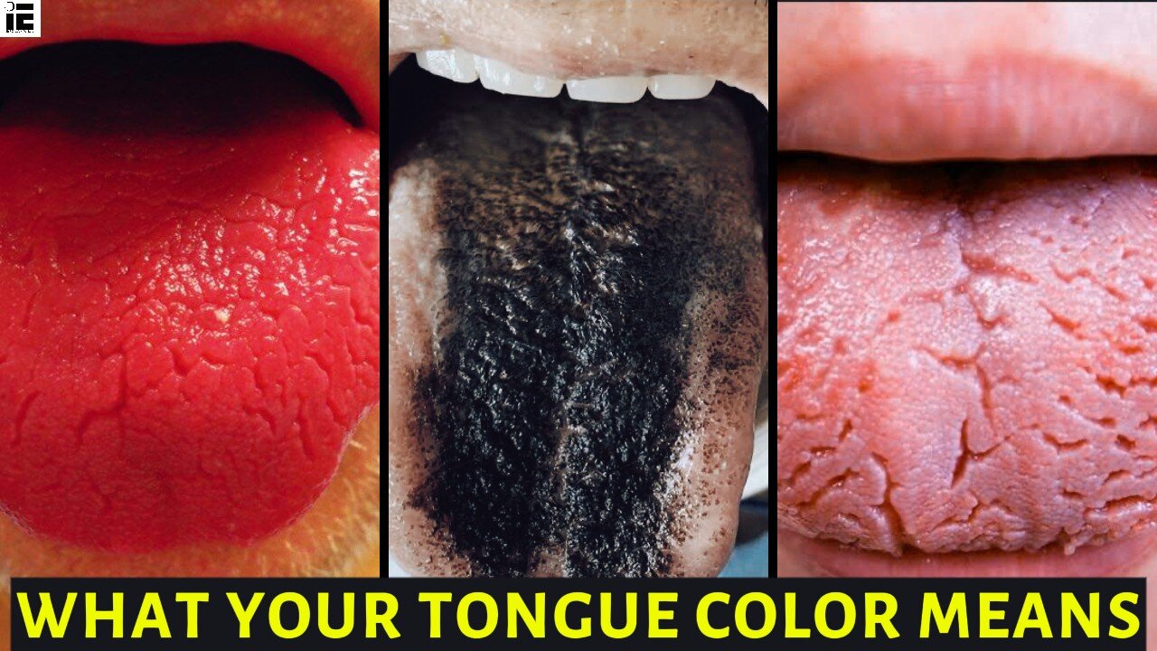 How Your Tongue’s Color, Texture & Appearance Affect Your Health