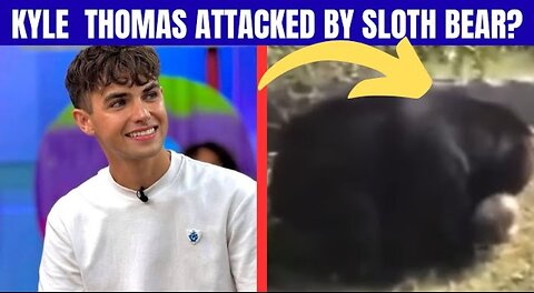 Kyle Thomas bear attack truth, Kyle Thomas sloth bear, Kyle Thomas news update, Kyle Thomas rumor