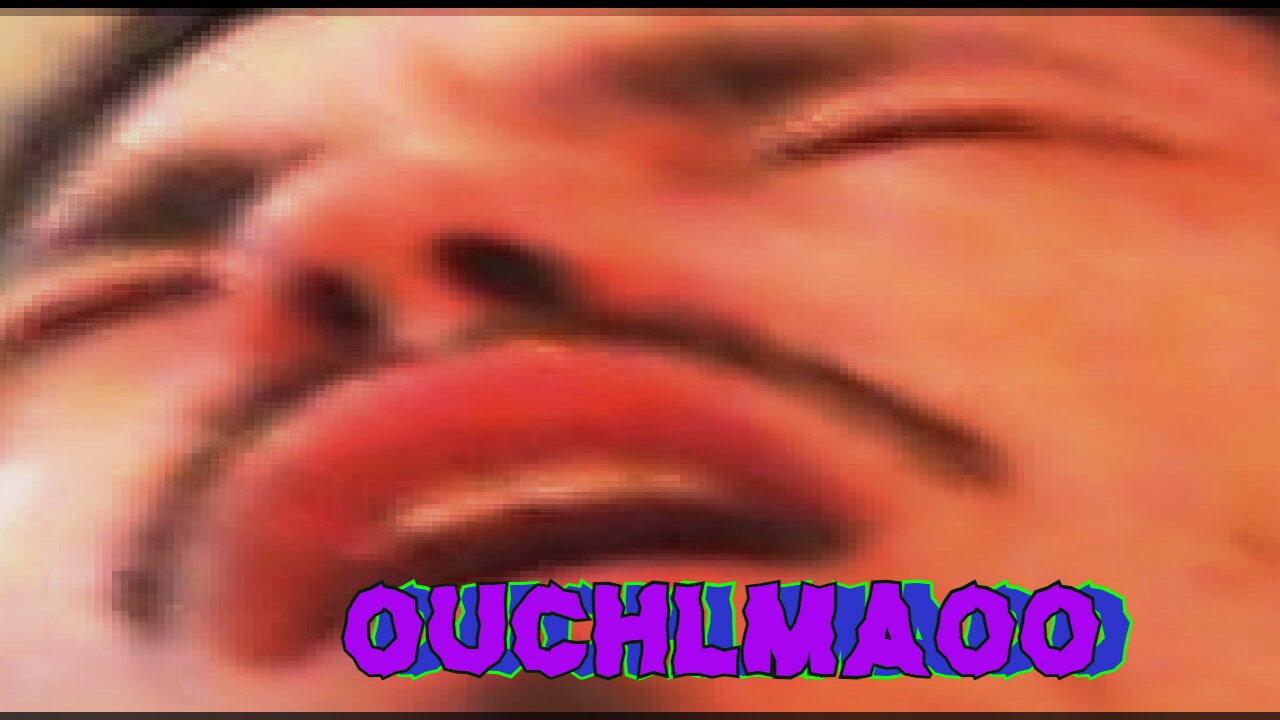 Midnight Oblivion Pt 391: ouchlmaoo