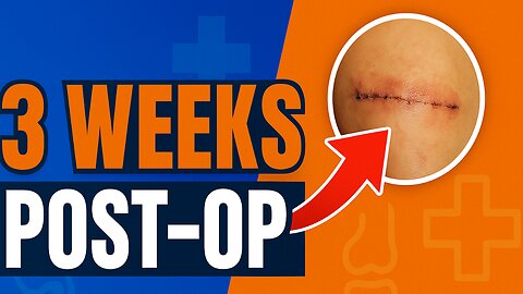 3 Weeks After ACL Surgery