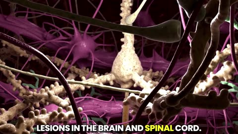 STUDY: mRNA “Vaccines” Disrupt the Blood-Brain Barrier and Destroy Neurons 