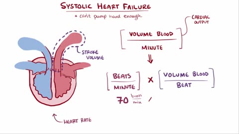 An Osmosis Video: Congestive Heart Failure (CHF) Explained