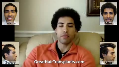 Dr. Brett Bolton Transforms Shoe Salesman into Model with Hair Transplant