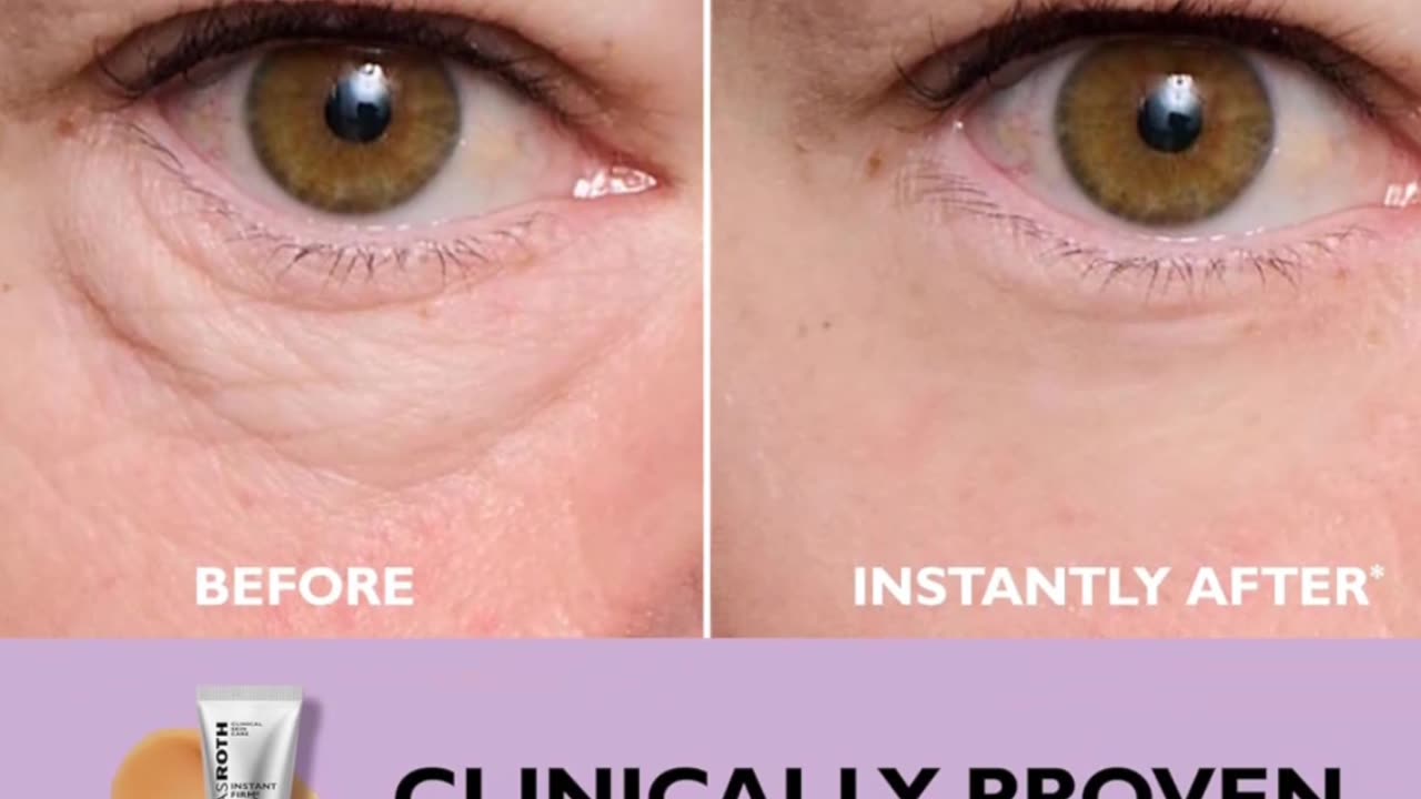 Peter Thomas Roth Instant FIR Mx Eye Tightener | Easy-Wear Formula for Instant Firming, Smoothing