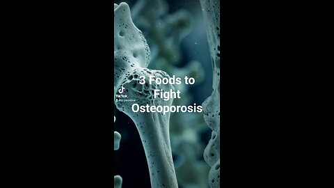 Food that Fight Osteoporosis