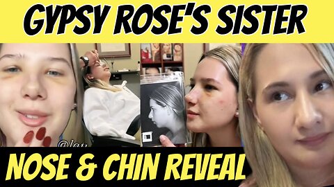 Gypsy Rose’s Sister UNRECOGNIZABLE! Nose Job & Chin Implant! 😱