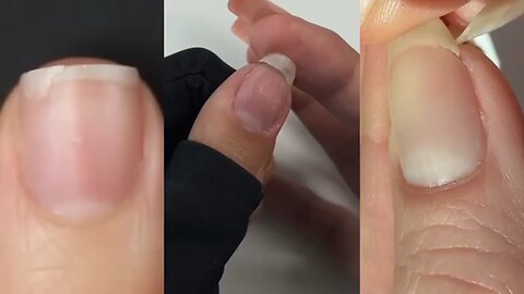 Grow your nail faster in 3 days