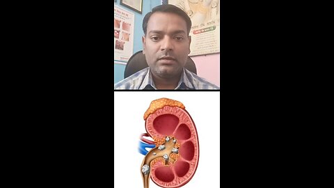 क्या पथरी से गुर्दे खराब हो सकते है ।