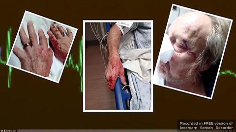 ONLY NIGGERS BEAT THE FUCK OUT OF OLD LADIES AND WHITE MEN WITH DEMENTIA