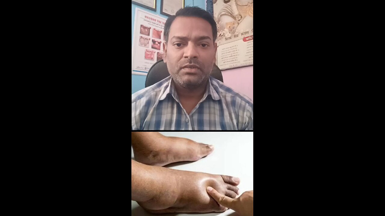 सूजन आना ।