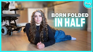 My Body Was Folded In Half When I Was Born | BORN DIFFERENT