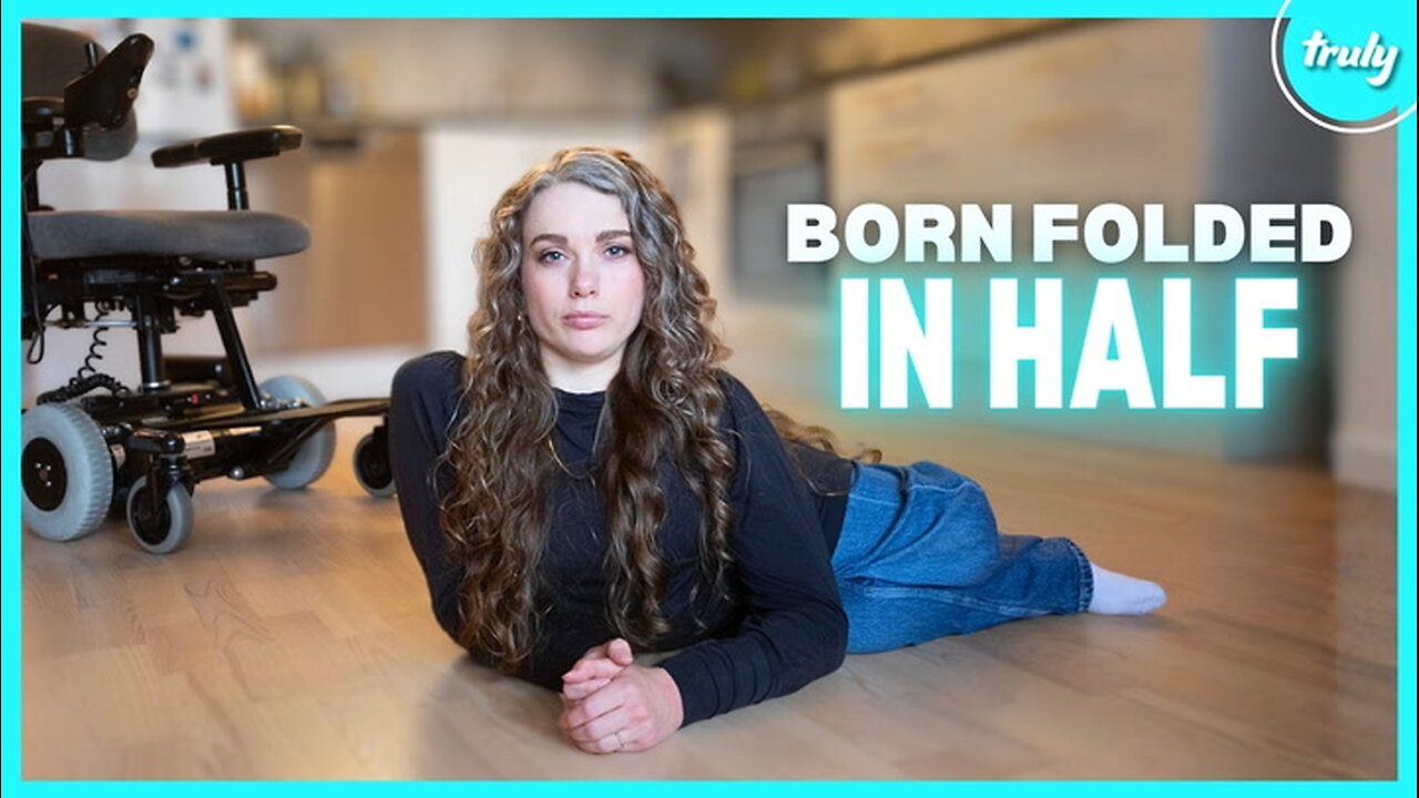 My Body Was Folded In Half When I Was Born | BORN DIFFERENT