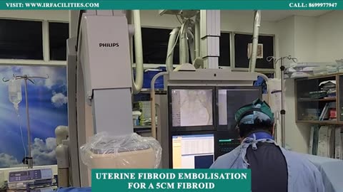 Uterine Fibroid Embolisation for a 5cm Fibroid | Effective Treatment by Dr. Sandeep Sharma