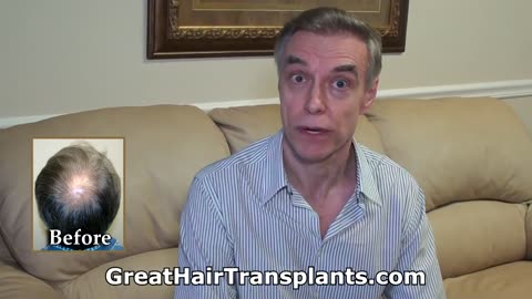 Dr. Brett Bolton Delivers Major Change with MaxHarvest™ Hair Transplant