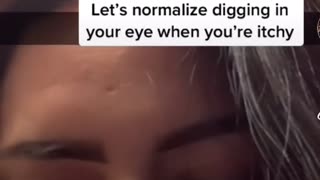 😂 Let's Normalize Digging in Your Eye When You're Itchy