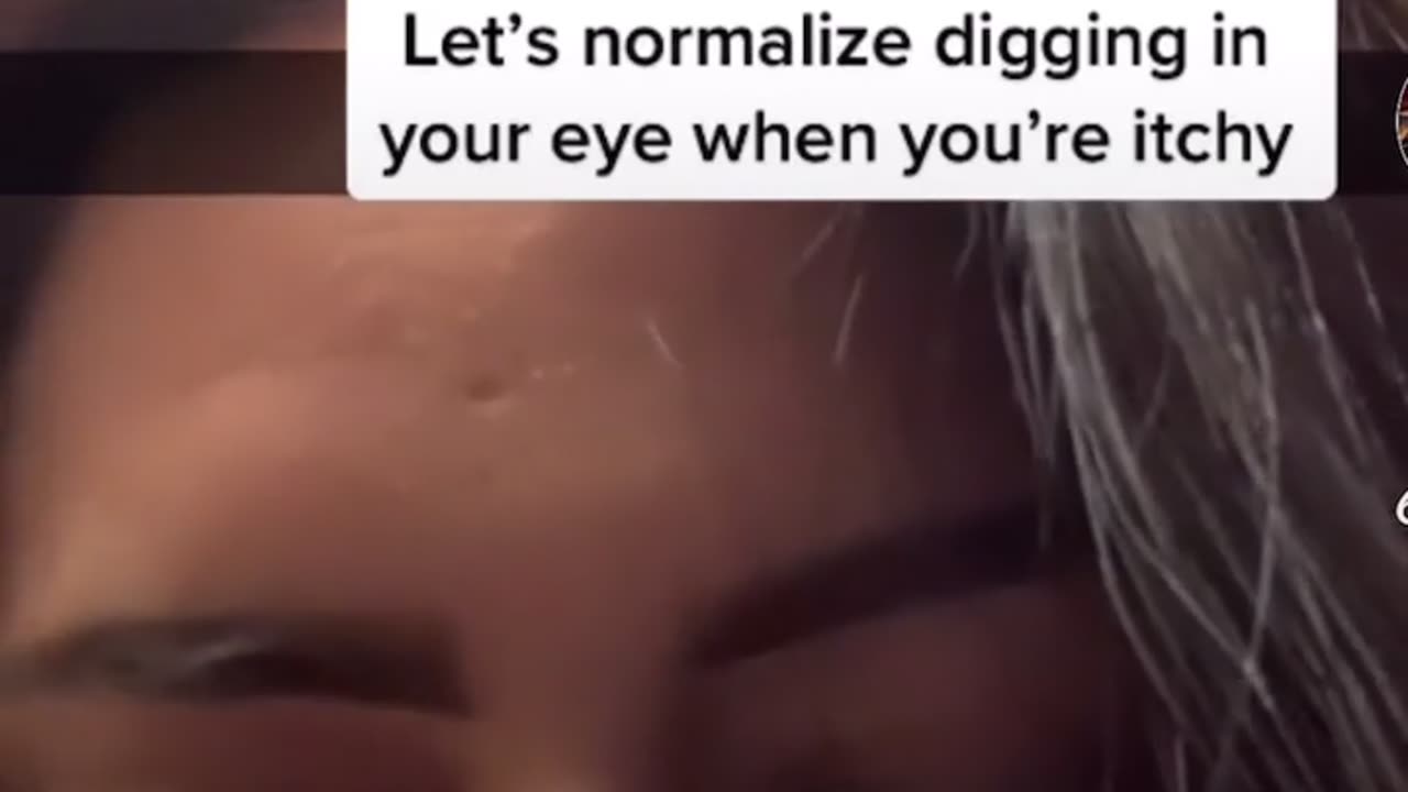 😂 Let's Normalize Digging in Your Eye When You're Itchy