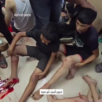 Hospital shows the aftermath of the Israeli massacre in Al-Maghazi refugee camp