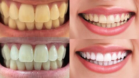 how whiten your teeth naturally