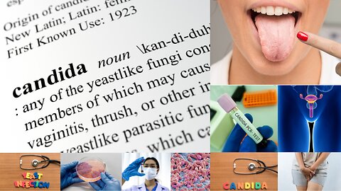 Candida and Women’s Health | The Complete Guide to Preventing, Treating, and Healing