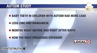 Baby Teeth, Autism and Heavy Metals - Heavy Metals in Vaccines