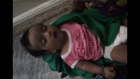 Telanaga: 3 month old baby died few minutes after polio vaccination