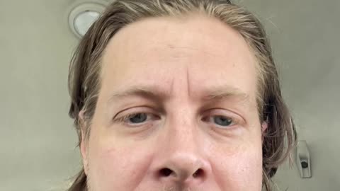 Comney obstruction , Candace Owen’s , Canada Organs